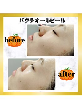 グランディールアン(GRANDIR UN)/艶美肌