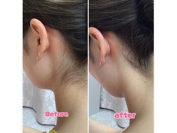 レディースシェービングエステ サンドリオン