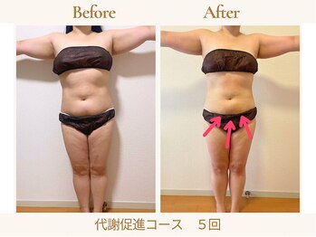 ヨサパーク ククナ 大塚(YOSA PARK kukuna)/