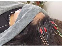 白記漢方堂鍼灸院(HAKU KI)/抜け毛、育毛鍼、頭皮ケア