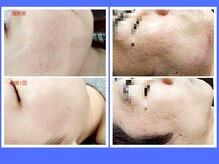 縁(en)の雰囲気（ポテンツァで美肌★）