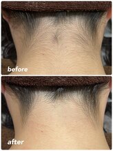 エステティック レイビス 青森店(RAYVIS)/意外と見られてる後ろ姿！