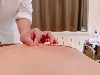 高田馬場はりきゅう院/睡眠の症状への鍼灸