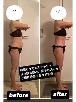 サロンド アートボックス/ぽっこりお腹や、反り腰の改善!