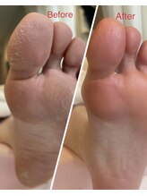 ミヨン 喜多見店(Miyong)/足裏角質ケア