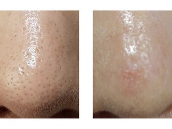 パピヨン/ララピール＊ビフォーアフター