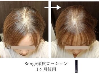 こもれび/頭皮ケアの変化