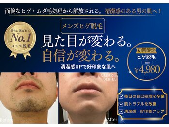 リュール(Lueur)の写真/【ヒゲ特化型ヒゲモード大好評】ヒゲが生えている範囲は全て照射◎痛み軽減◎完全個室で清潔感ある肌へ♪
