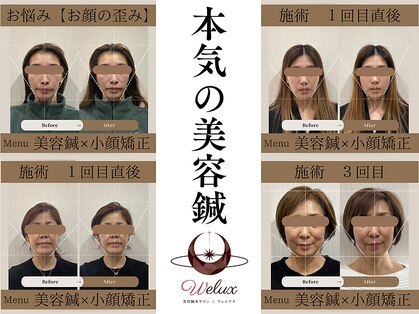 ウェルクス(welux)の写真