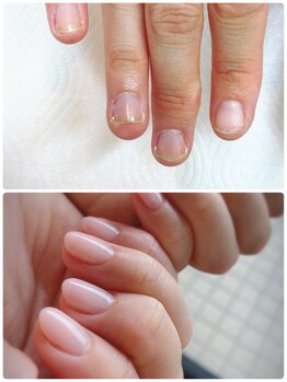 ココ ネイル サロン アンドスクール(COCO.NAIL SALON＆SCHOOL)/爪噛み改善7700