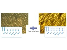 フェイシャルスタイリストサロン 高崎店(Facial Stylist Salon)/キメのケア例（9）