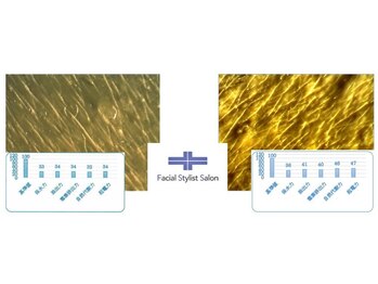 フェイシャルスタイリストサロン 高崎店(Facial Stylist Salon)/キメのケア例(9)