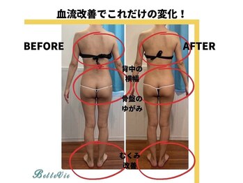 ベルヴィー(Belle vie)/セクシャル美ボディケア120分