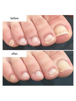 ネイルアトリエ ボン(nail atelier bon)/フットネイルケア