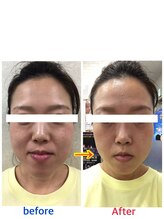 サロン ド ベトリー(Salon de Betory)/40代女性 むくみスッキリ小顔に