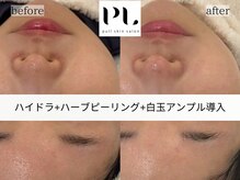 プル スキンサロン(pull skin salon)/