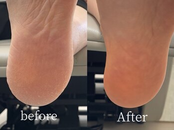 ディーヴァス(DIVAS)/つるふわ角質ケア