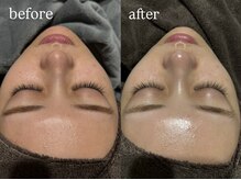 ビビ(Vivi)/白玉つるん陶器肌