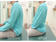 カイロライン 三鷹整体院/頭痛×猫背矯正/beforeafter