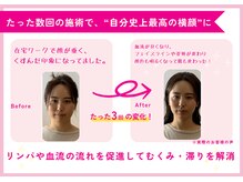理想の小顔 福島店/お身体とお顔の両方にアプローチ