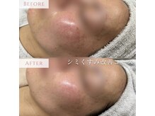 サロンドブランシール(salon de blanchir)の雰囲気（眉毛はサロンで整える時代☆あなたに合った眉毛をご提案します）