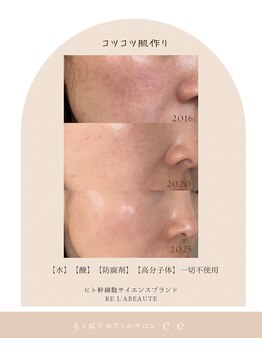 シャルム エスボーテ(charme Esbeaute)/ハーブピーリング