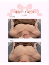 ロココ 安城店(Rococo)/バストアップ症例