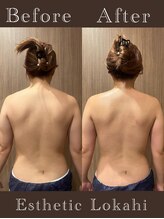 ロカヒ(Lokahi)/ビフォーアフター