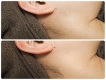 朝と詩/もみあげ周りもスッキリ！