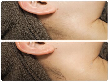 朝と詩/もみあげ周りもスッキリ！