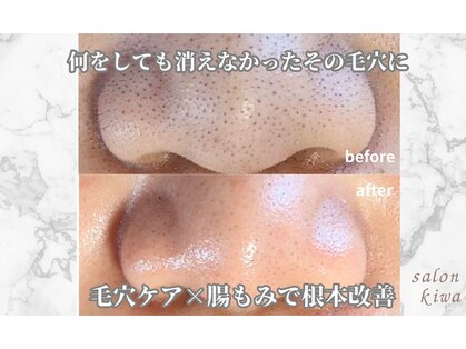 サロン キワ(salon kiwa)の写真