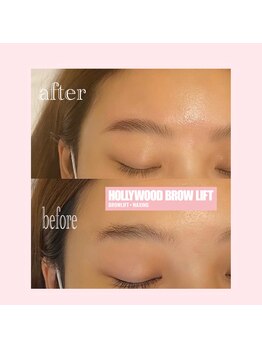 ティアラ(TIARA)/ハリウッドブロウリフト