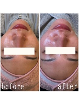 リベル ビー(ReBell Bee)/フェイスワックス