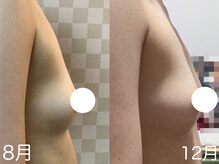 ハレオラ(HaleOla)/20代☆ブラを変えただけでも！