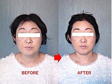 アトラス/初回のお客様のBefore＆after