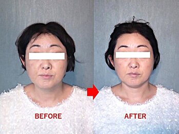 アトラス/初回のお客様のBefore＆after