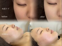 アンド バイ ビューティー(& by beauty)