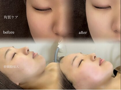 アンド バイ ビューティー(& by beauty)の写真