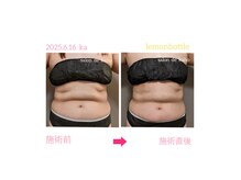 サロン ド 花歩 松山本店の雰囲気（韓国美容【レモンボトルとRED SHOT】最強の脂肪分解で速攻痩身！）