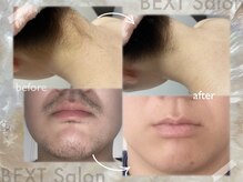 ベクスト(BEXT)の雰囲気（★Before　After★）