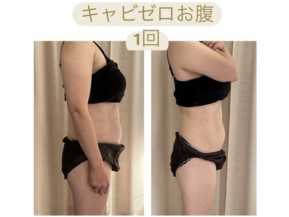 ビボーン ボディ(美bone body)の写真