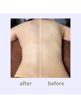 シェノンミュリール(Chainon Murir)の写真/肩こりや首の痛みから頭痛もする疲れに。しせいが悪くて太って見える印象も一気にケア！