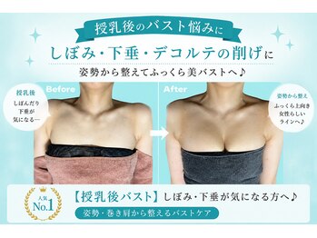 ネイト ワックス(Neit Wax)の写真/下垂・削げデコルテが気になる方へ。姿勢から整えてふっくら美バストへ♪ 授乳後/下垂/デコルテの削げ