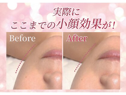 リフト 越谷(Lift)の写真