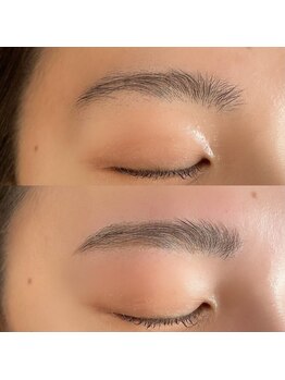 グランツ(GLANZ)/ハリウッドブロウリフト