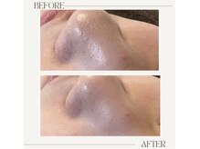 アンド(&.)/before/after