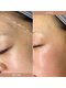 スー 梅田(suu)の写真/【フェイシャルワックス】で毛穴の汚れや皮脂のつまり・産毛・古い角質を取り除き美肌の土台を作り艶肌へ◎