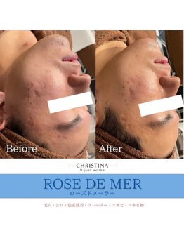 フルアナ(Hu ruana)/フェイシャルエステ