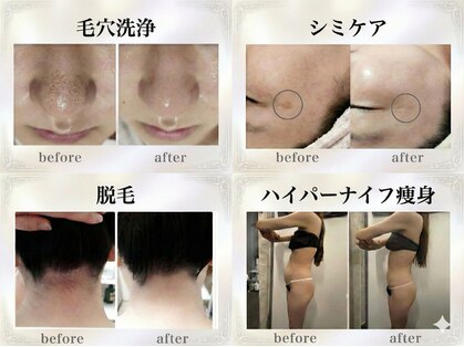 カヌヌ(kanunu)の写真