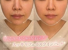 ステラ グランデ 福岡博多